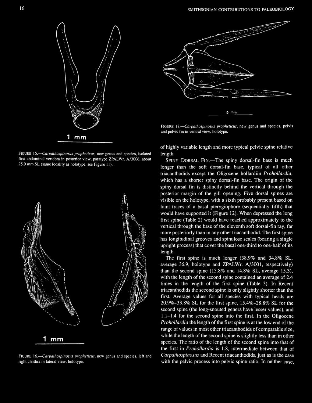 Carpathospinosus propheticus, new genus and species, pelvis and pelvic fin in ventral view, holotype. of highly variable length and more typical pelvic spine relative length. SPINY DORSAL FIN.