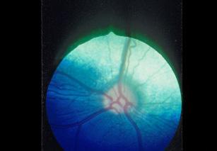 5 The English Springer Spaniel and Progressive Retinal Atrophy (PRA) NANCY M.
