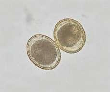 The eggs were about 73 x 58 microns in size with a thick shell wall and contained a large, dark single-celled embryo. They were identified as Baylisascaris procyonis, the raccoon roundworm (Figure 1).