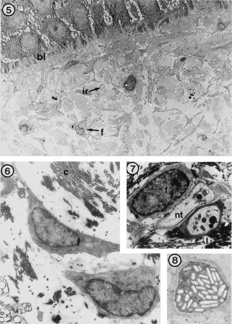 320 K. JACKSON ET AL. Fig. 5. Crocodylus porosus. TEM of the apex of IS0 region of the dermis, showing high concentration of cells.