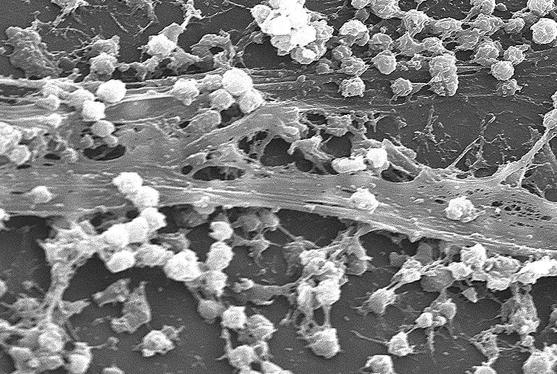 Outside a laboratory in the real world Biofilms are