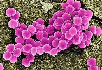 Example: Staphylococcus aureus Penicillin 91.5% R Staphylococcus aureus (2012) -Lactams (MRSA) 27.5% R Fluoroquinolones: 15-28% R Macrolides: 19.