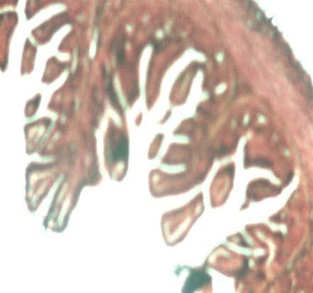 Here, Villi (V), Intestinal gland (IG), Muscularis mucosae (MM), Muscularis externa () and Serosa (S) are shown.
