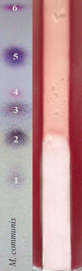 Sa slike 5.10 jasno se može uočiti da je kod etarskih ulja vrste M.