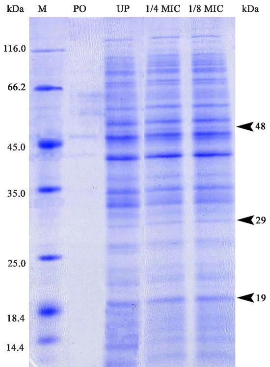camaldulensis u koncentracijama 1/4 MIC i 1/8 MIC. Slika 5.14. Proteini A.