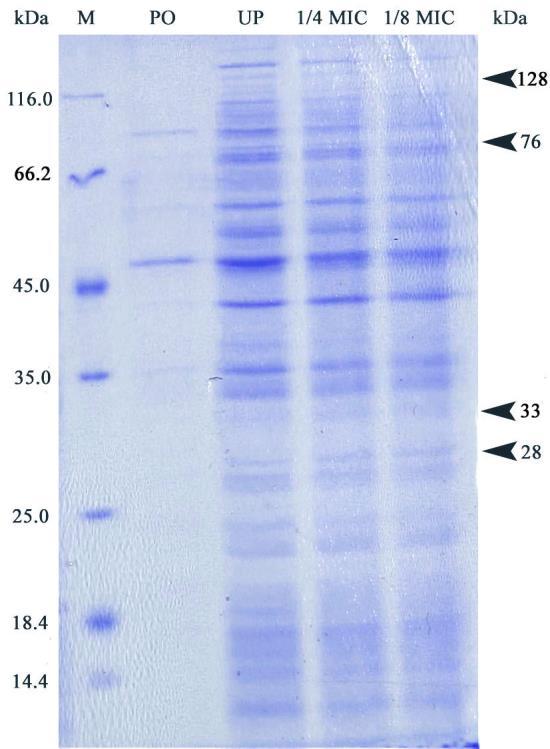 i 1/8 MIC ukupni proteini nakon tretmana ćelija etarskim uljem M. communis) Slika 5.15. Proteini A.