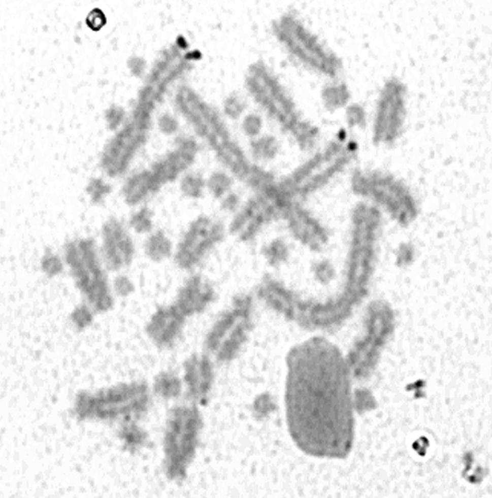 Laguna et al. Figure 2 Incomplete metaphase after silver staining showing the Ag NORs on the telomeric region of chromosome 2 of Amphisbaena ridleyi from Fernando de Noronha (Pernambuco, Brazil). 05).