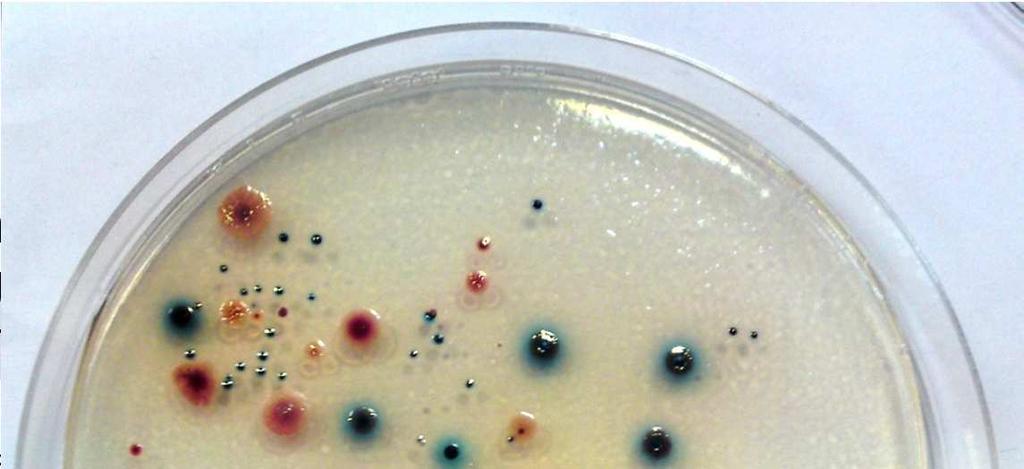 EXPERIMENT Bacteriological analyses: Bacteria Total heterotrophic bacteria Intestinal