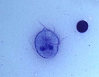 FREE Photo credit: Dwight Bowman, MS, PhD, Cornell University FIGURE 1 Staining can aid in the identification of Giardia trophozoites by improving visualization of the organism and its internal