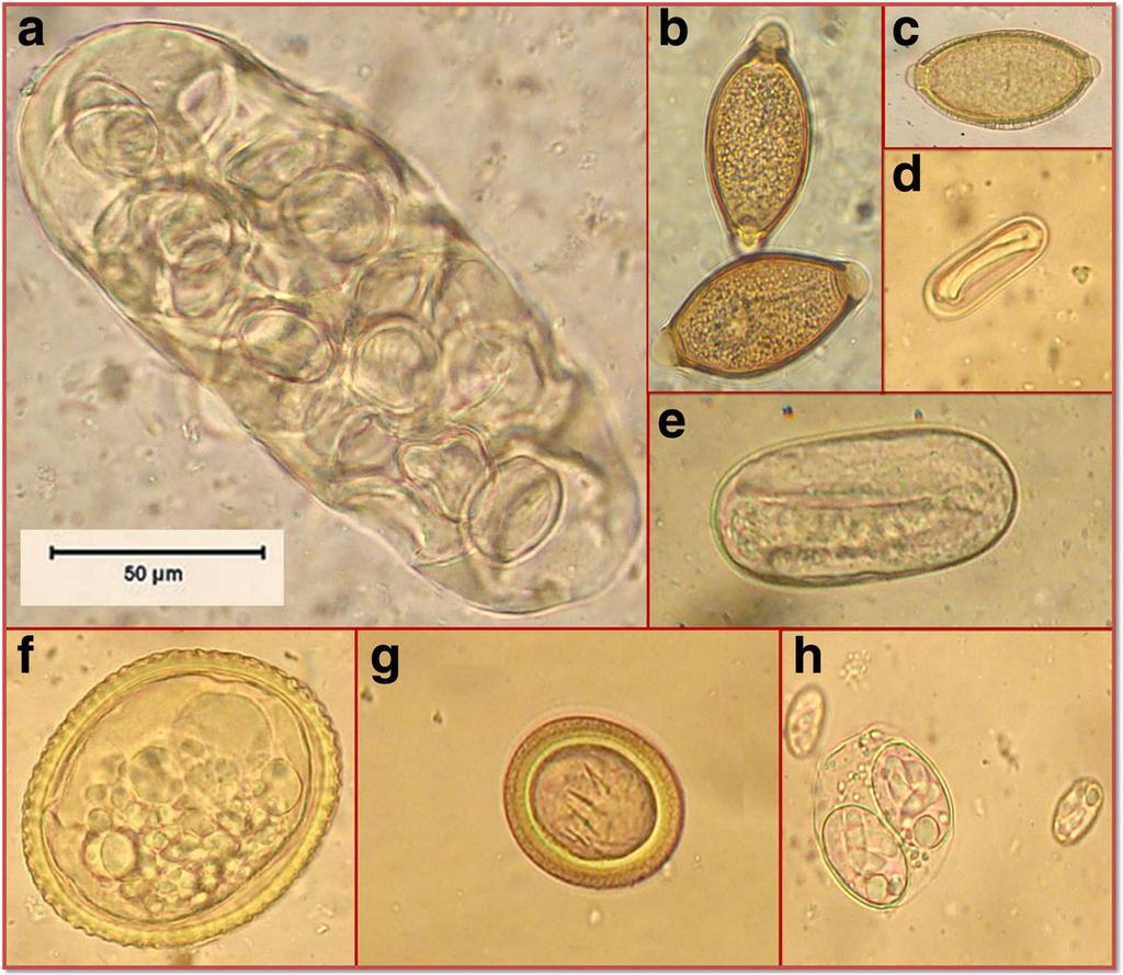 Oudni-M rad et al. Parasites & Vectors (2017) 10:280 Page 4 of 8 Fig. 2 Cestode and nematode eggs and oocysts observed in the canid faecal samples. a D. caninum egg-capsule. b Trichuris spp.