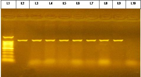 417 Spa gene PCR: When MRSA isolates were subjected to spa gene detection, spa gene was detected in 34/36 (94.4 %). However, we did not find the spa gene band in two isolates (5.6%).