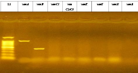 418 Figure 5: van gene genotyping. L1: 100-1500 bp DNA ladder, bands of vana (1030 bp) and vanb (433) were shown.