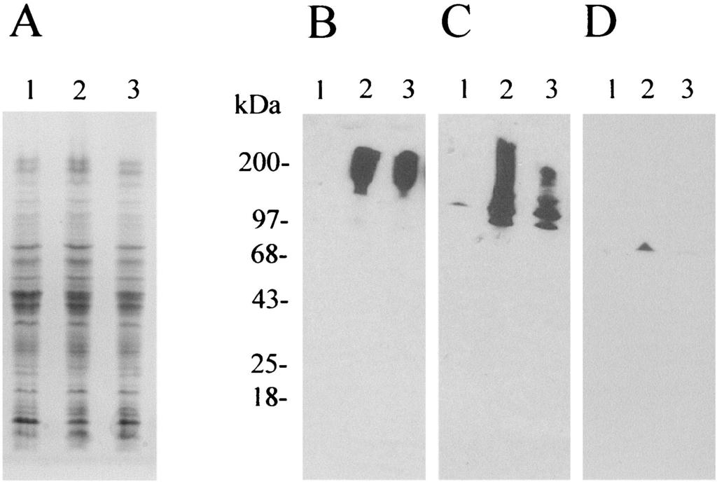(B) Immunoblots of the SDS-PAGE gel shown in panel A. The gel blot was exposed to mouse antiserum obtained 10 months after infection with wild-type B. bronchiseptica as the primary antibody.