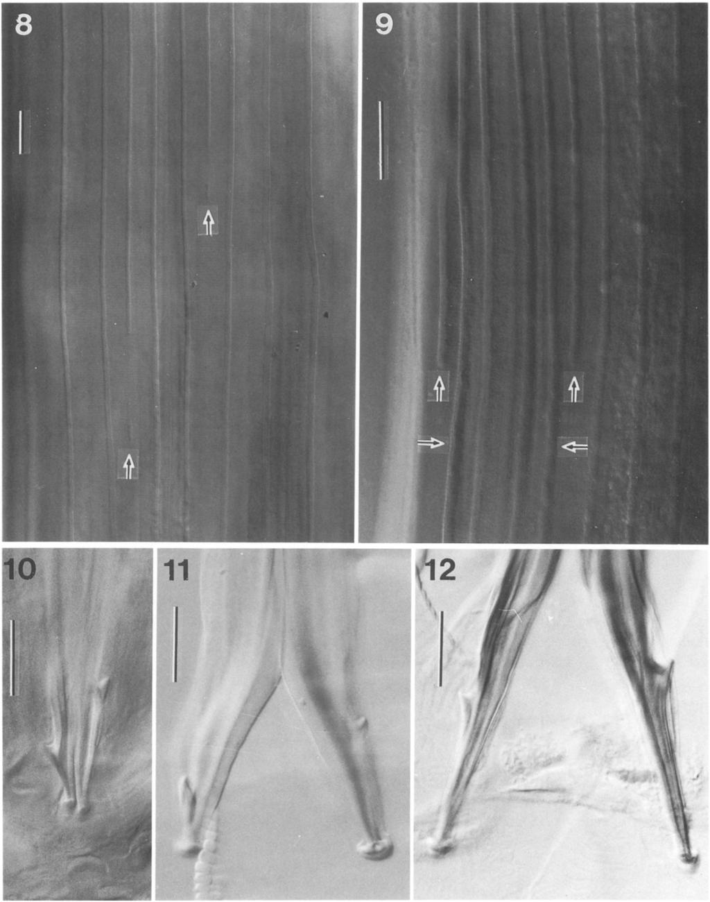 112 THE JOURNAL OF PARASTOLOGY, VOL. 80, NO. 1, FEBRUARY 1994 FGURES 8-12. Lateral synlophe patterns and spicule tips of 3 species of Haemonchus (scale bars = 25 gm). 8. Lateral synlophe of H.