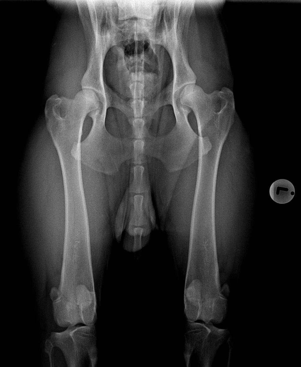 occurs) due to inadequate seating of the femoral head in the acetabulum and the stresses related to such abnormal seating.