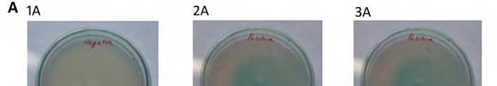 Antibiotic Resistance, Biofilms and Quorum Sensing in Acinetobacter Species 195 central mechanism for autoinduction of multiple virulence factors (Gonzalez et al., 2001;Joly-Guillou et al.