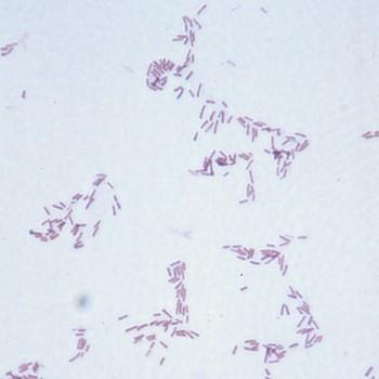 Site Determines Pathogen Mouth Peptococcus Peptostreptococcus Actinomyces Skin/Soft Tissue S. aureus S. pyogenes S. epidermidis Pasteurella Bone and Joint S. aureus S. epidermidis Streptococci N.