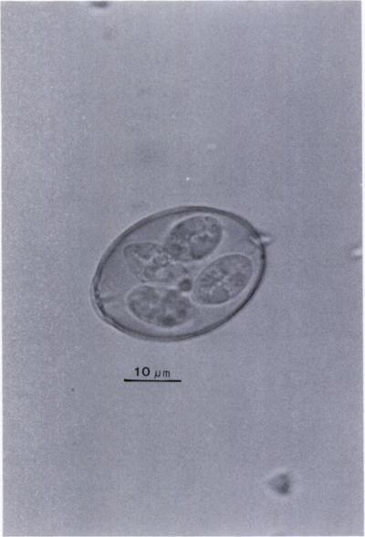 128 JOURNAL OF WILDLIFE DISEASES, VOL. 32, NO. 1, JANUARY 1996 f 10pm FIGURE 2. One drawing of oocyst from Figure 1. 1977), whereas similar parasite intensity to 10 91 F1:uRE 1.