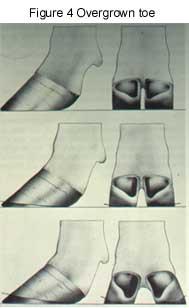 Biomechanics If we look at the feet of beef cattle we find that the sole tends to be concave with the wall extending beyond the sole.
