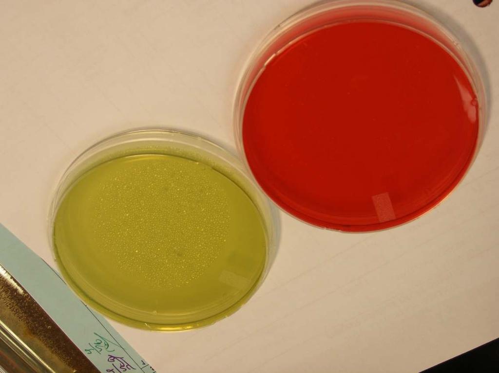 Bacterial Culture Results No bacterial growth on any plates after