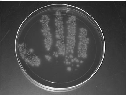 Contamination of Glove Following Contact with Patient with Clostridium difficile Bobulsky G et al.
