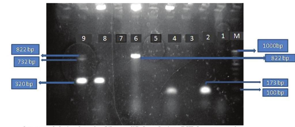 PC, positive control for vana gene; NC, negative control; Lanes 1-5 positive for vana gene (732 bp). Fig. 2.
