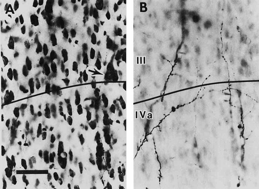 172 A.L. HUMPHREY ET AL. Fig. 1. Photomicrographs of the boutons from the X-cell axon shown in Figure 9. A. Nissl stained cell bodies in layers I11 and IVa.