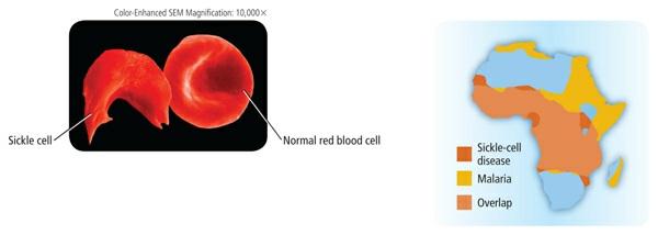 Dr. Stanley Flegler/Visuals Unlimited Figure 2 Left: Normal red blood cells are flat and disk-shaped. Sickle-shaped cells are elongated and C-shaped.