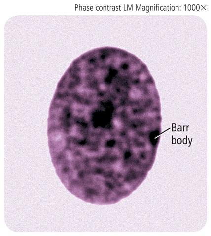 In 1949, Canadian scientist Murray Barr observed inactivated X chromosomes in female calico cats. He noticed a condensed, darkly stained structure in the nucleus.