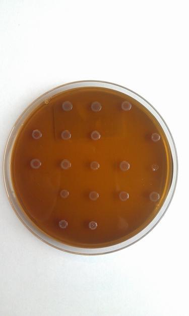 Phenotypic tests the Gold standard Agar