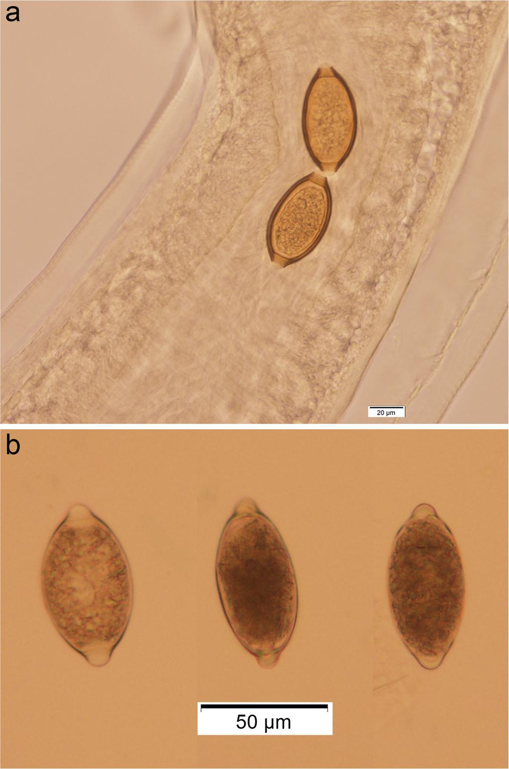 Ketzis SpringerPlus (2015) 4:115 Page 6 of 7 Figure 3 a and b Trichuris eggs (100x) of different sizes seen with a fecal flotation from one St. Kitts cat. If mislabeling occurred and only T.
