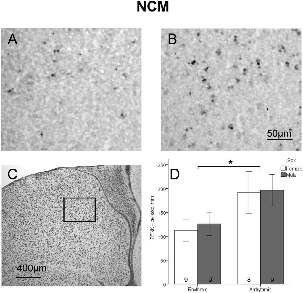 Neural Responses to Rhythmicity of Birdsong Figure 2. Density of ZENK expressing cells in NCM.