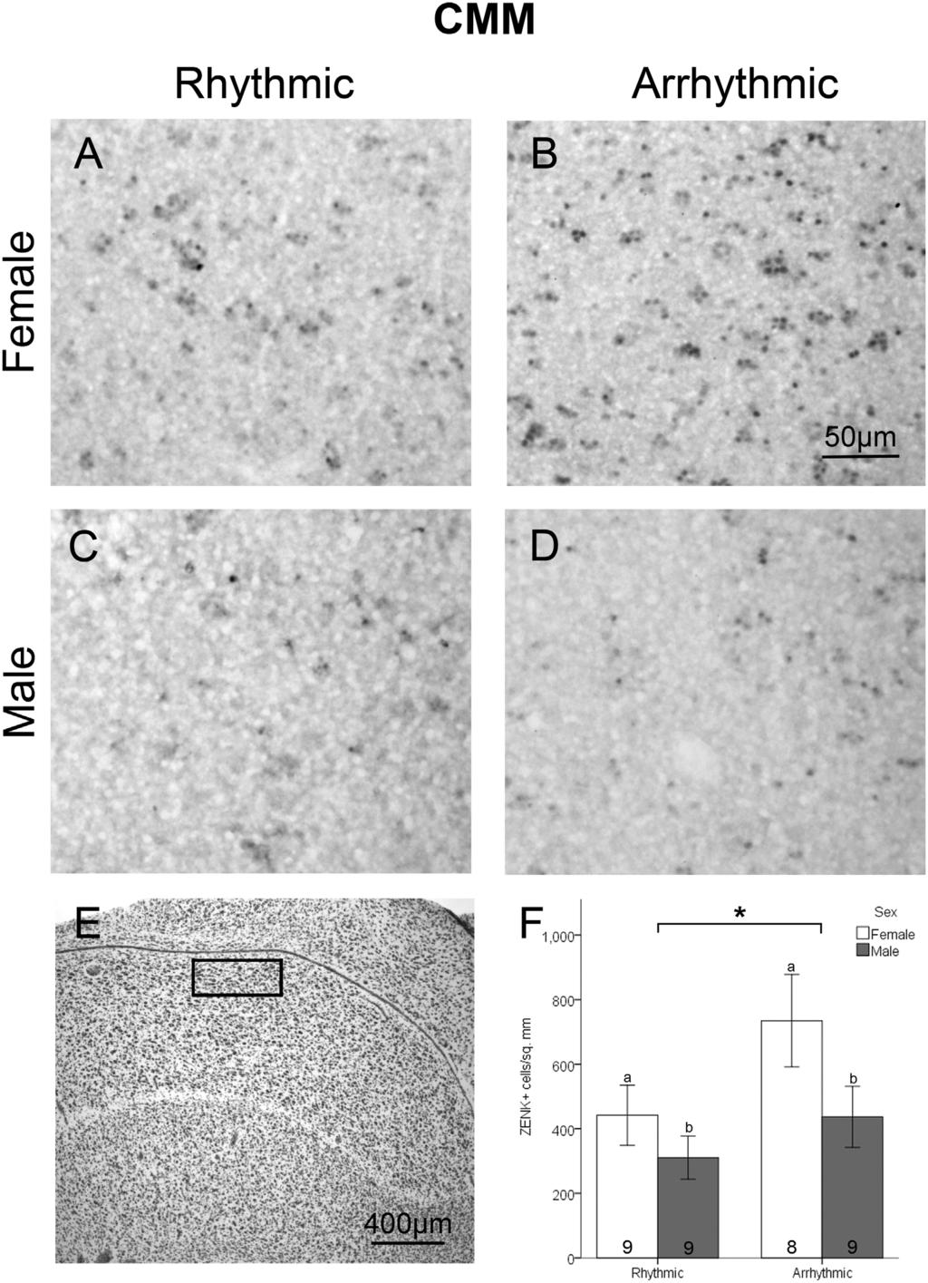Neural Responses to Rhythmicity of Birdsong Figure 3. Density of ZENK expressing cells in CMM.