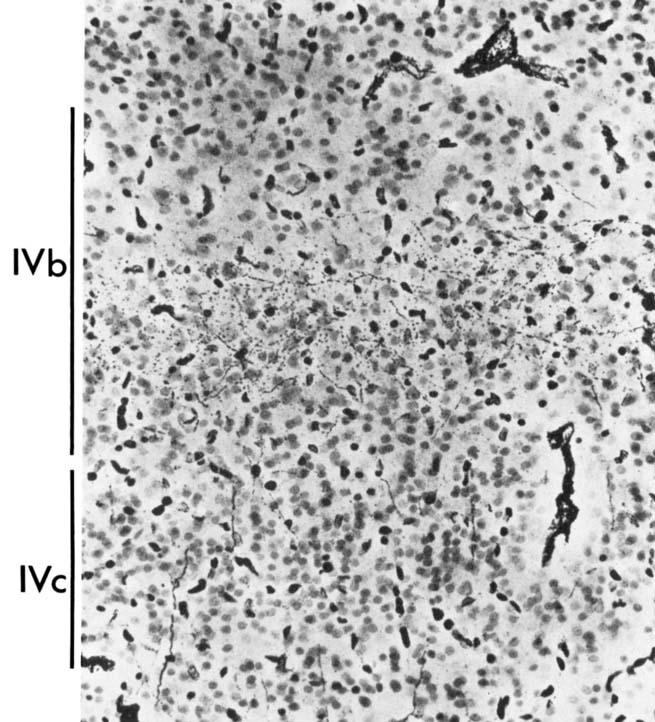 DISTRIBUTION OF GENICULO-CORTICAL FIBERS IN THE MACAQUE 435 IVb IVC Figure 6B 0.1 mm on the right of the figure (anteriorly) and becomes progressively poorer towards the left of the map.