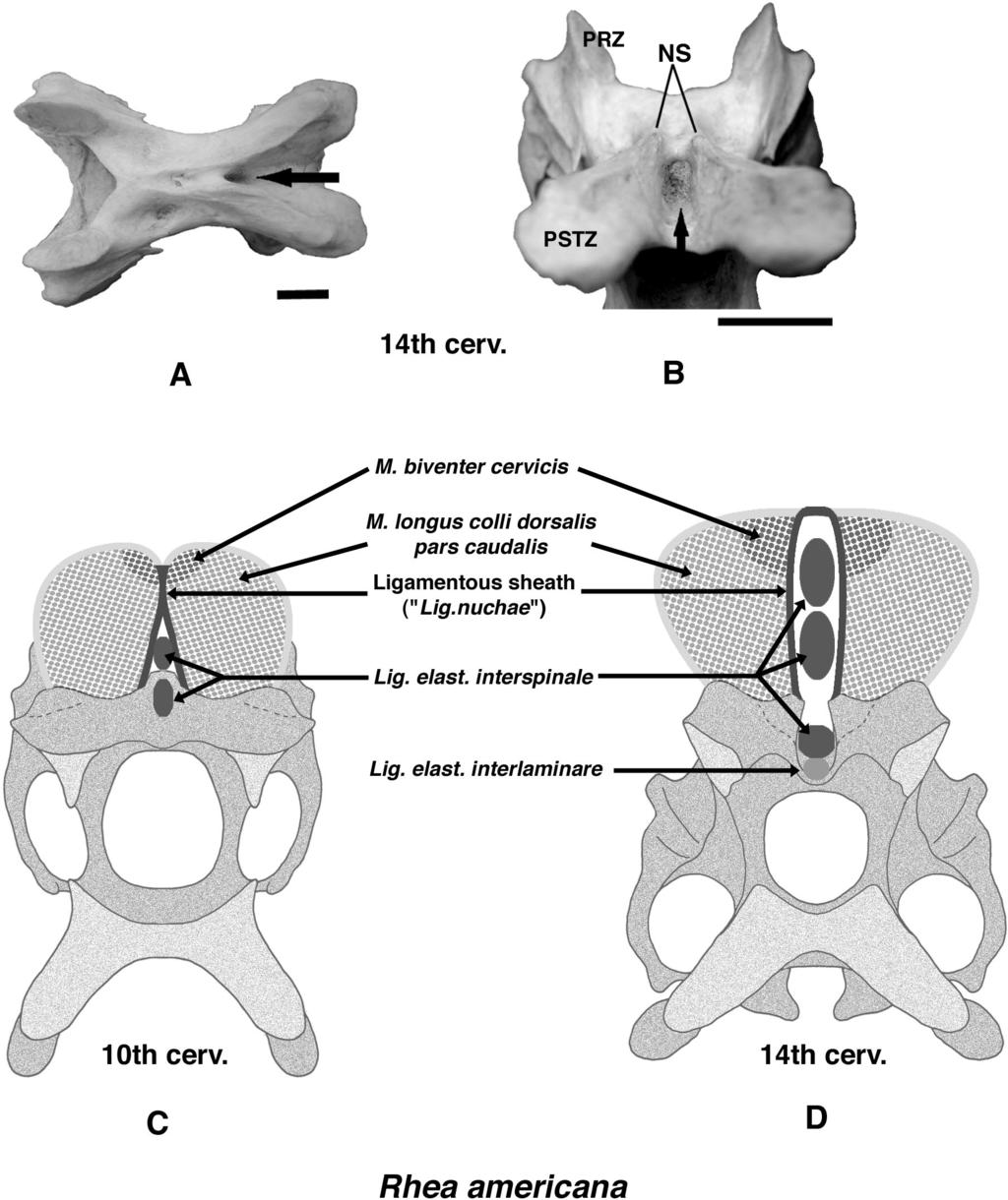 168 JOURNAL OF VERTEBRATE PALEONTOLOGY, VOL. 24, NO. 1, 2004 FIGURE 2. Topological relationships among the vertebra, ligaments and median epaxial muscles in Rhea americana.