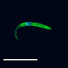 TRP1-GFP but not GFP-TRP1DN localizes in a polarized fashion at the sporozoite periphery.