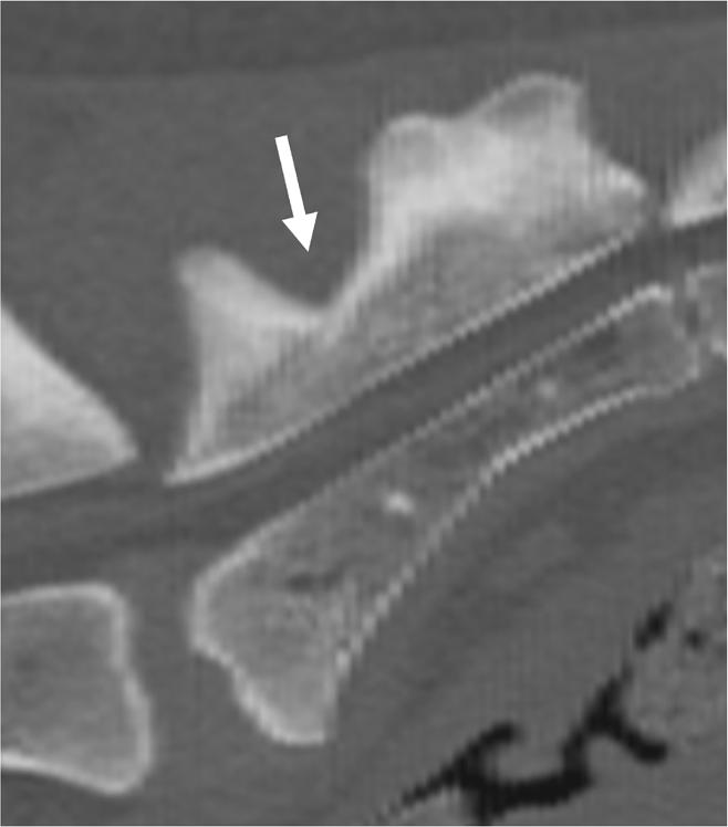 L7. 15 cases (16.3%) from only the ventrodorsal radiograph in 62 cases (67.4%) and from only the laterolateral radiograph in ten cases (8.7%).