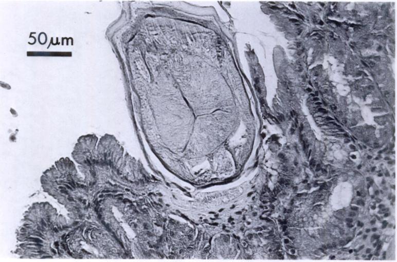 426 JOURNAL OF WILDLIFE DISEASES. VOL. 25, NO. 3, JULY 1989 FIGURE 1. Histological section through the esophagus of an adult Physaloptera retusa.