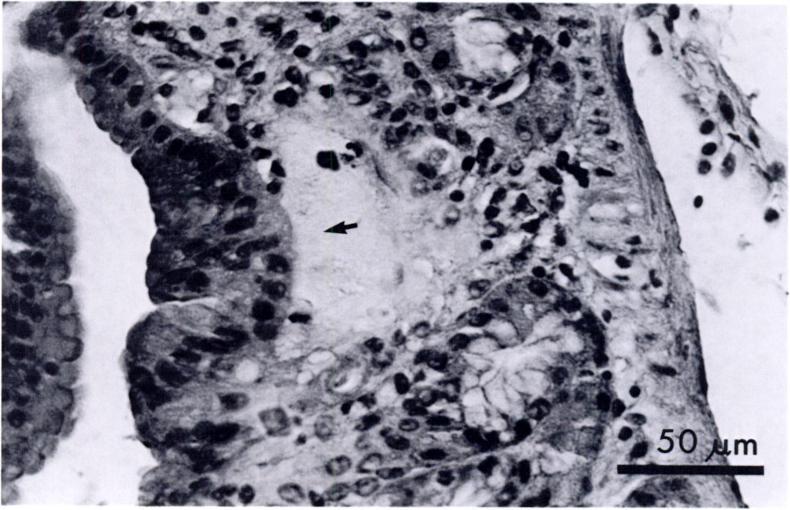 SHORT COMMUNICATIONS 427 U-, I-.- FIGURE 2. Fibrous scar (arrow) from previous attachment of adult Physaloptera retusa. Note absence of gastric glands. H&E. The relationship between the number of P.