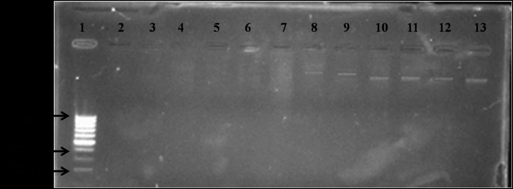 Figure-1: Plasmid profiles of multidrug resistant Pseudomonas aeruginosa isolates 1: DNA Ladder; 2: PASp22 isolate; 3: PAP7isolate; 4: PAU3 isolate; 5: