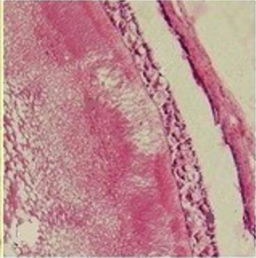 Deutoplasmic granules started to form and 2-3 layers of small cells existed in the granulose. (c) Stage III follicle: 15 25 mm in the length.