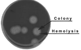 coli/klebsiella Result + + - Strep or mixed Staph/ Strep + - - Staph (check hemolysis) - + - Strep - - + Gram- nega-ve (E.