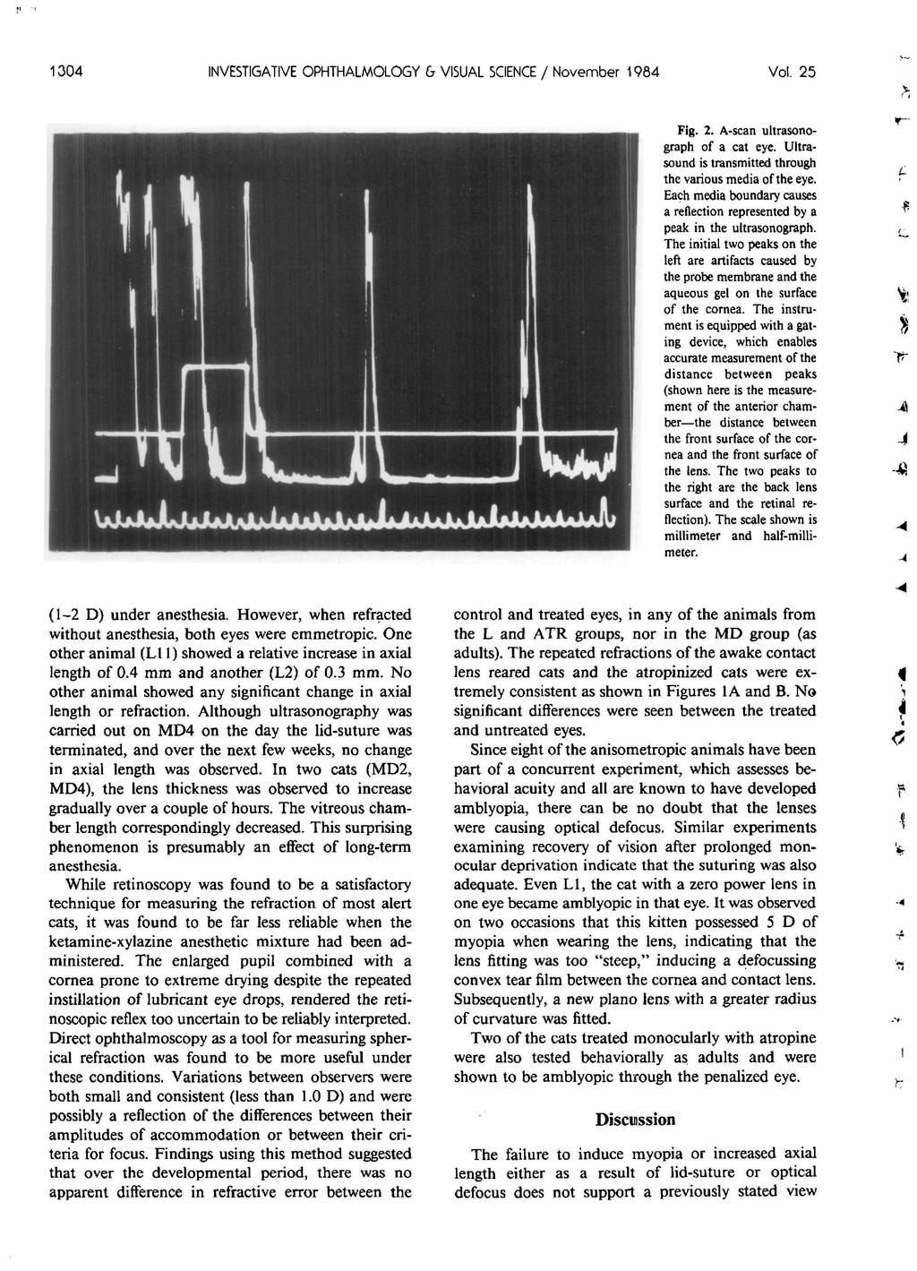 1304 INVESTIGATIVE OPHTHALMOLOGY G VISUAL SCIENCE / November 1984 Vol. 25 Fig. 2. A-scan ultrasonograph of a cat eye. Ultrasound is transmitted through the various media of the eye.