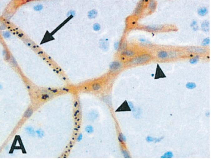 Organ-specific sequestration can be linked to pathology: cerebral malaria and