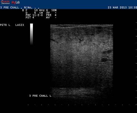 Figure II.9. B-mode ultrasonographic appearance of the teat of a ewe (subgroup A1), before challenge with M.