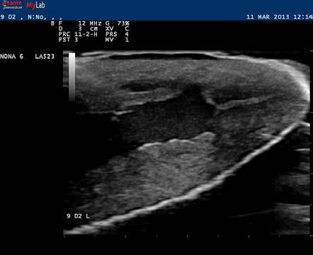 Images taken on a MyLab 30 ultrasonography system with linear transducer, imaging frequency: 12.