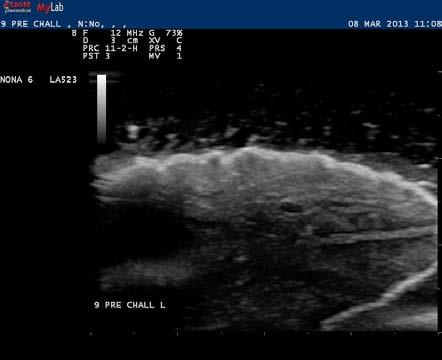 B-mode ultrasonographic apprearance of the parenchyma of the inoculated side of the udder of a ewe (subgroup A1), before