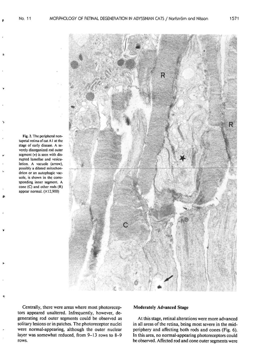 No. 11 MORPHOLOGY OF RETINAL DEGENERATION IN ABYSSINIAN CATS / Narfsrrom and Nilsson 1571 R Fig. 2. The peripheral nontapetal retina of cat A1 at the stage of early disease.