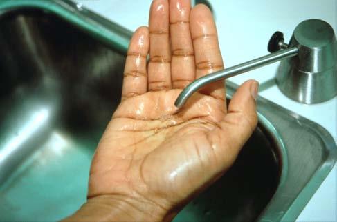 Antiseptic Handwashing Agent hands-free soap dispenser 9.