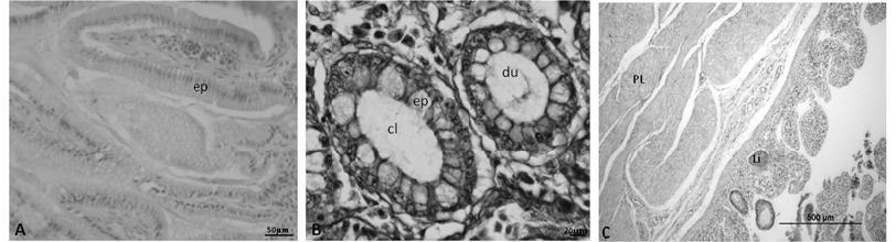 In the ileum the villi showed variable height coated by simple columnar epithelium composed of very goblet cells. The muscular layer of the mucosa was thin.